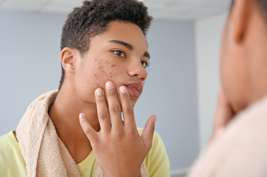 Your Skin’s New Best Friends-Turmeric and Charcoal